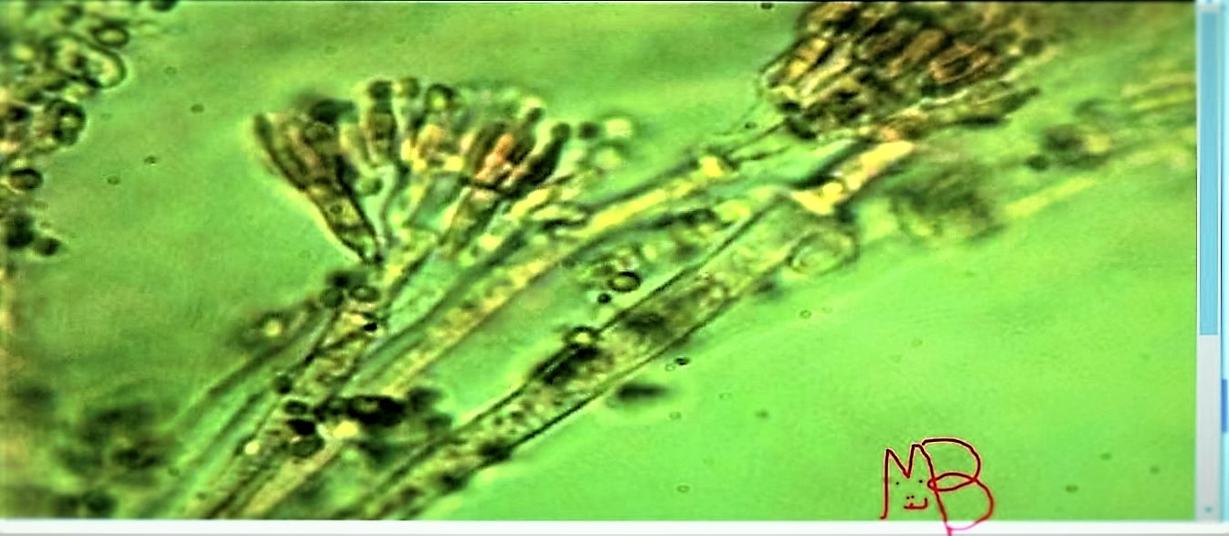 penicillina o aspergillus sp?